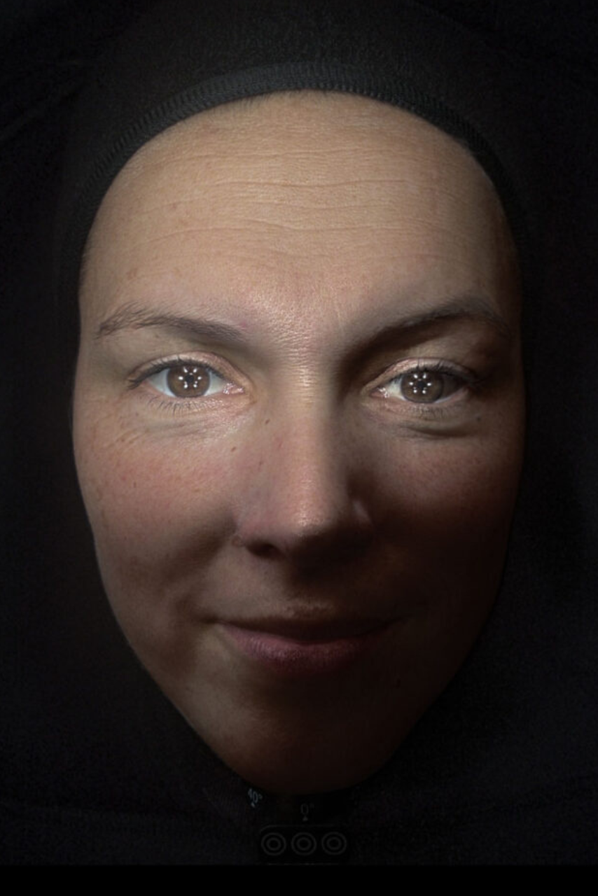 OBSERV 520x skin analysis in Warendorf and Münster with modern skin diagnostics